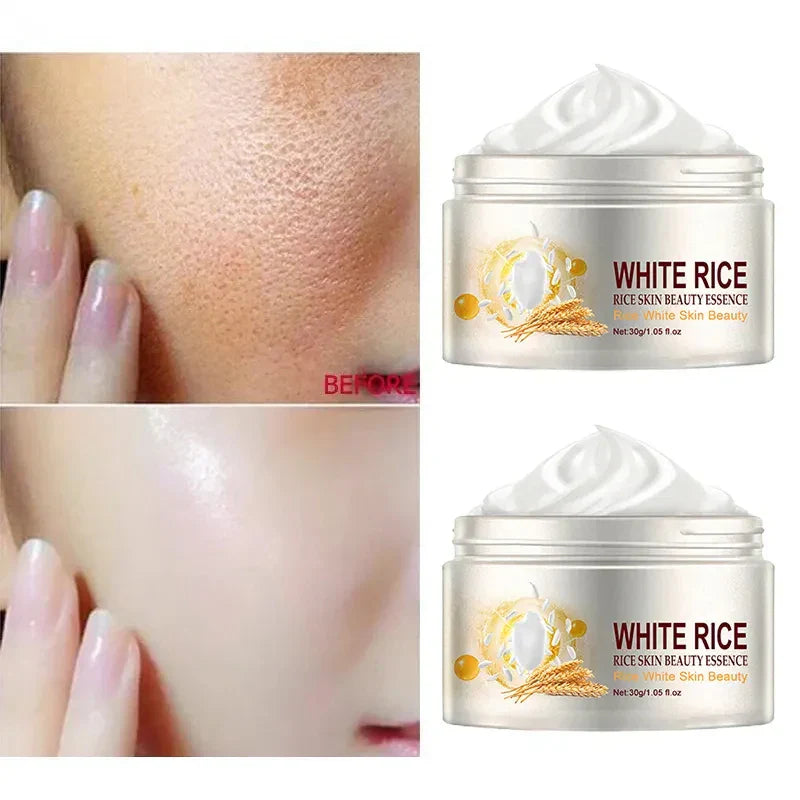 Facial Cream Acne Melasma Treatment Pigmentation Whitening Face Lifting Beauty Moisturizer Korean Cosmetics30g