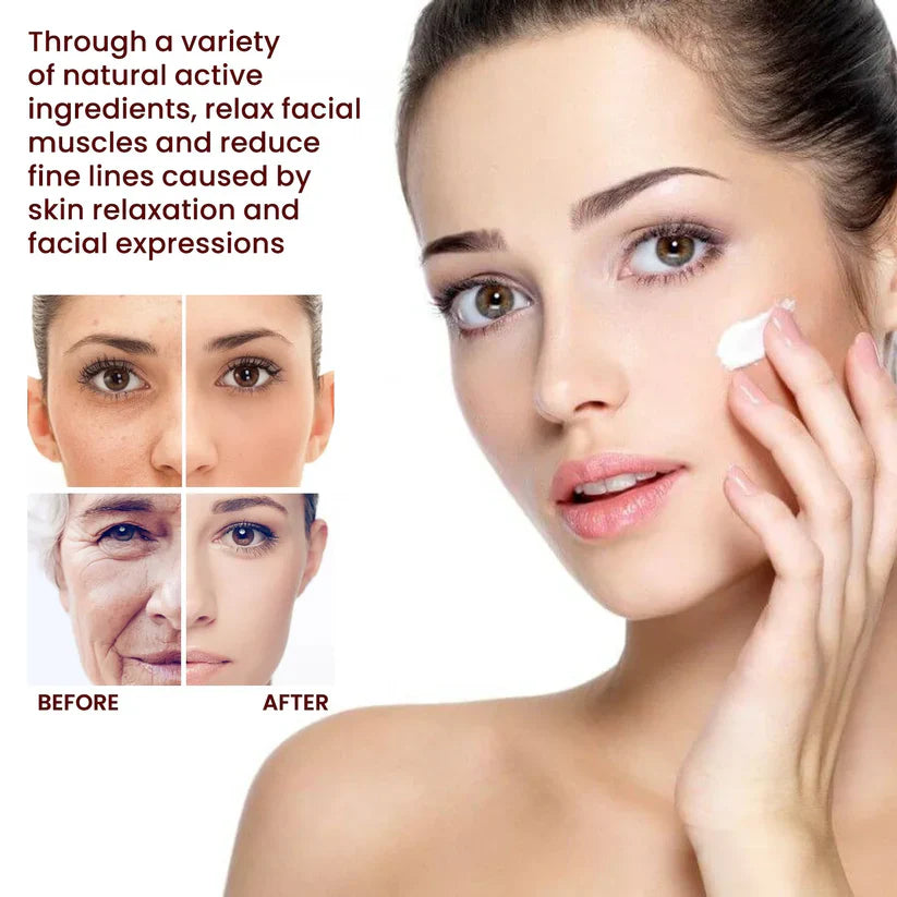 Facial Cream Acne Melasma Treatment Pigmentation Whitening Face Lifting Beauty Moisturizer Korean Cosmetics30g