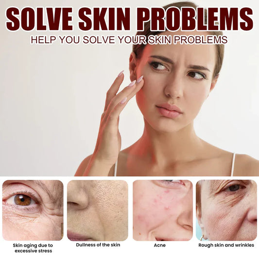 Facial Cream Acne Melasma Treatment Pigmentation Whitening Face Lifting Beauty Moisturizer Korean Cosmetics30g